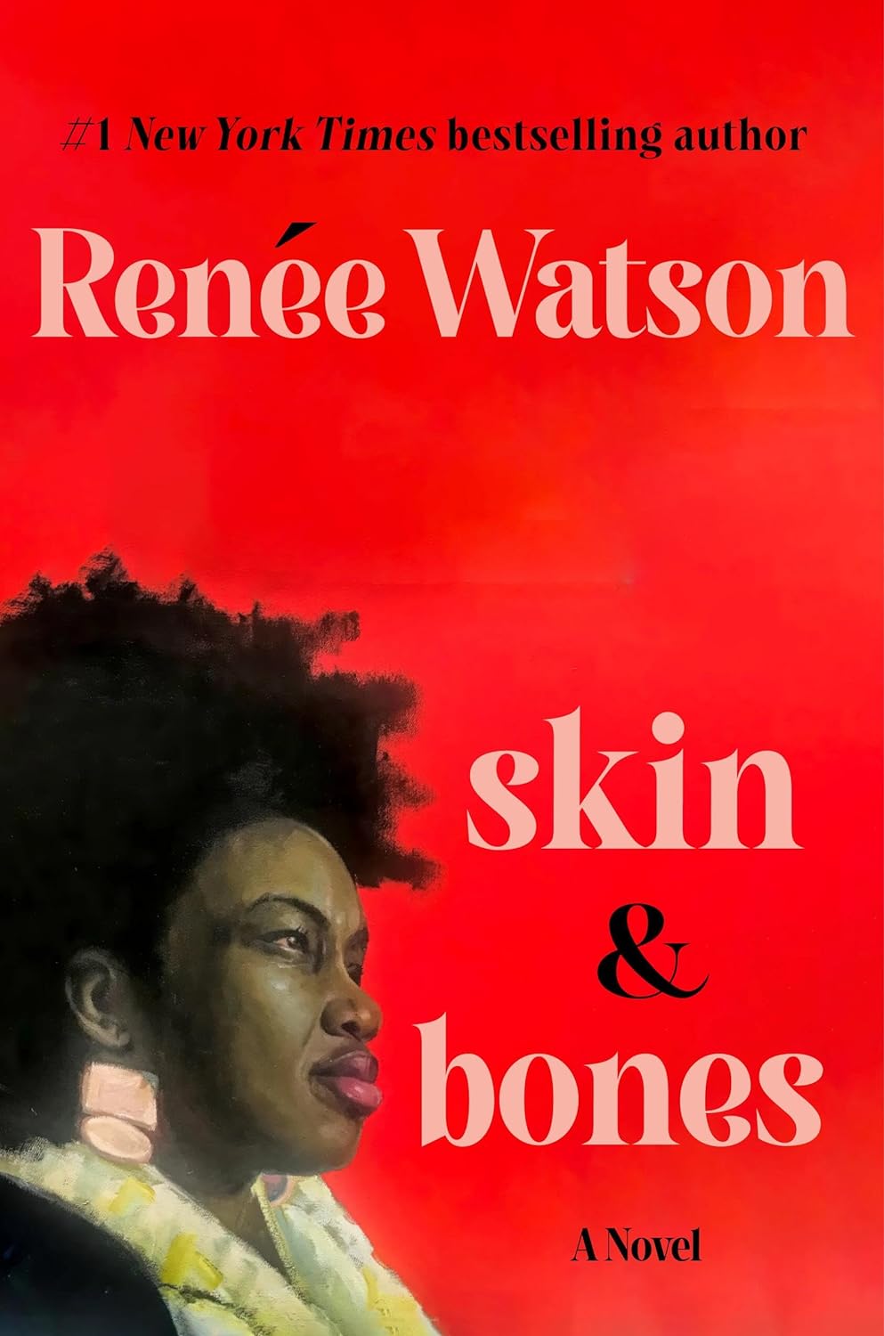 Skin & Bones book cover