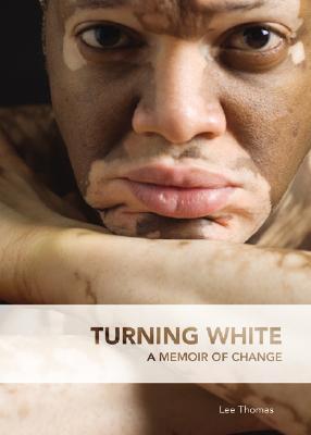 Turning White book cover