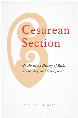 Cesarean Section book cover