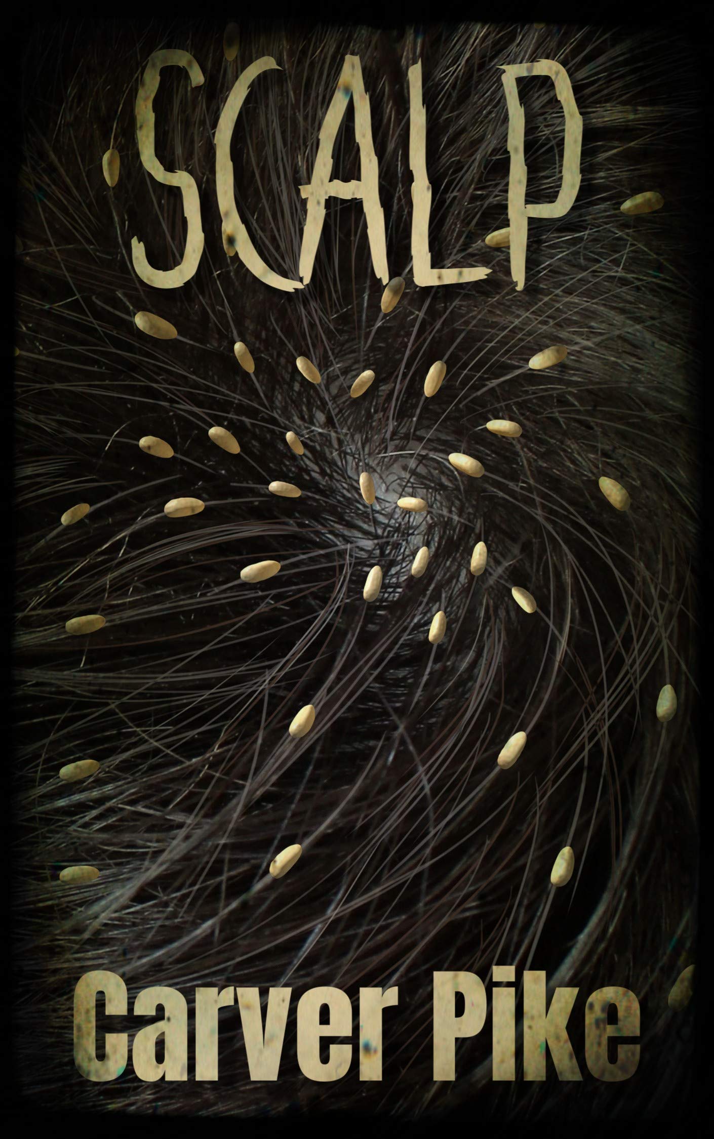 Scalp book cover